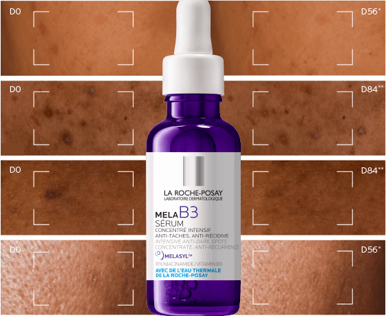 Serum przed i po